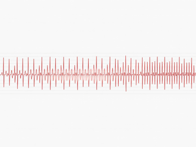 Detailed graph showing variations in heartbeats over time